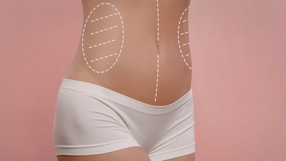 What Is CryoLean 360? The Non-Surgical Body Contouring Treatment Available in Fort Myers, Naples, & Sarasota